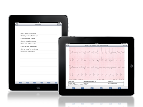 Rapid Paediatric ECG screenshot 3