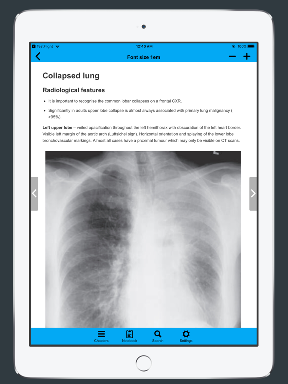 Screenshot #6 pour Chest X-Ray FlashCards