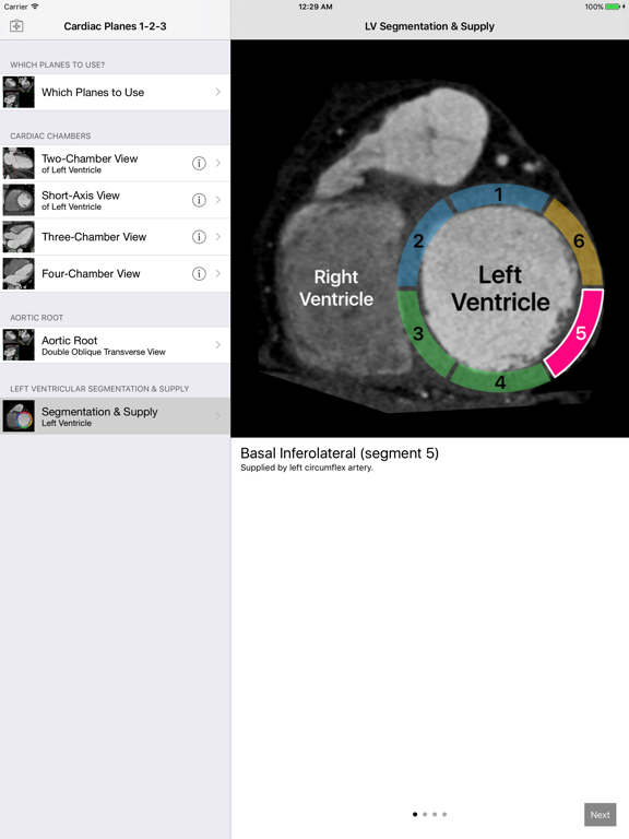 Screenshot #5 pour Cardiac Imaging Planes 1-2-3