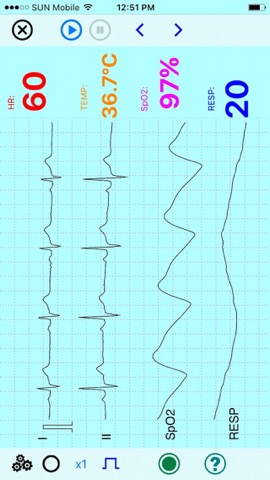 UltraLS   ECG SpO2 TEMPのおすすめ画像1