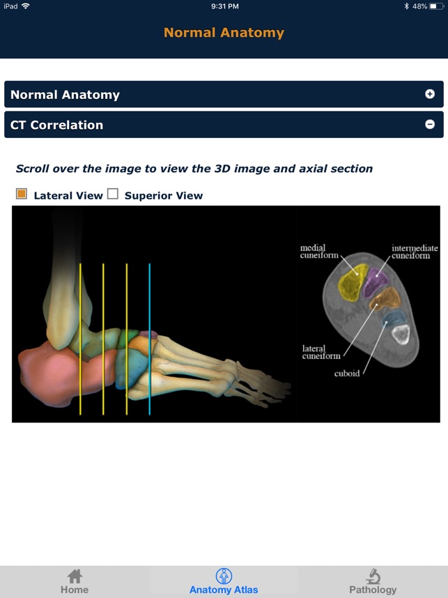 CTisus: CT of the Foot(圖4)-速報App
