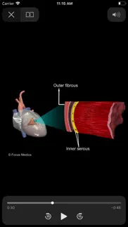 heart - digital anatomy problems & solutions and troubleshooting guide - 1