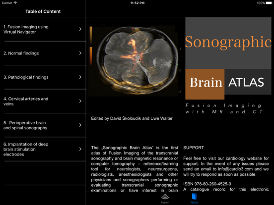 Sonographic Brain Atlasのおすすめ画像1