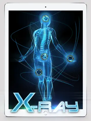 Captura 1 Best X-Ray iphone