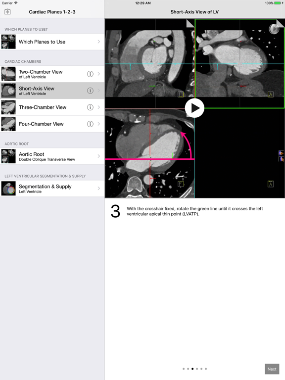 Screenshot #4 pour Cardiac Imaging Planes 1-2-3