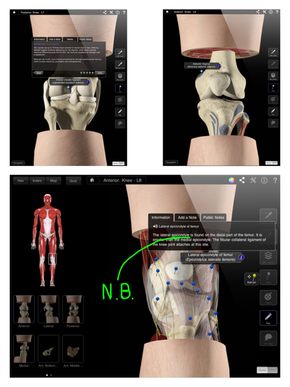 Knee Pro III for iPadのおすすめ画像4