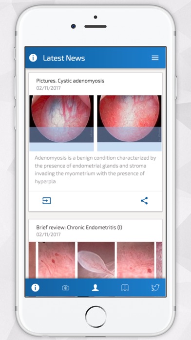 Screenshot #1 pour Hysteroscopy News