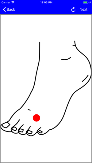 MobileWoundCare for Patients(圖3)-速報App