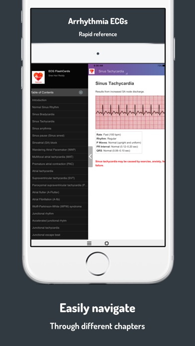 ECG FlashCards screenshot 4