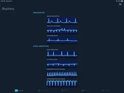 ACLS Rhythms and Quiz iPad image 2