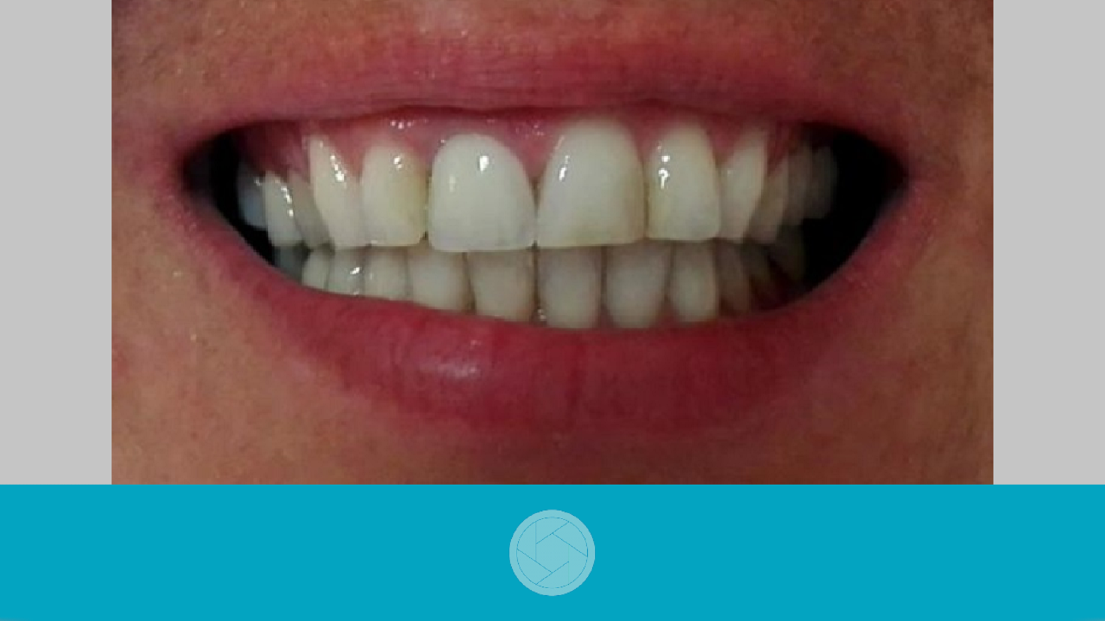Rayplicker™ Pics App Solution screenshot 2