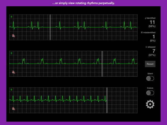 Screenshot #6 pour arrhythmia