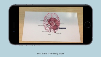 Human Brain - Augmented Realit screenshot 2