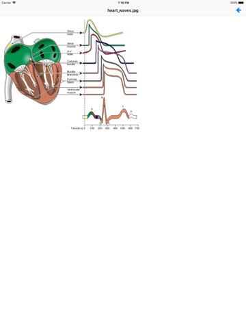 EKG Academyのおすすめ画像1