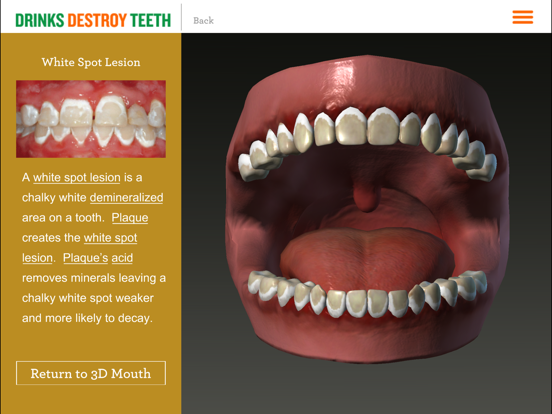 Screenshot #6 pour Drinks Destroy Teeth