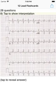 ekg academy problems & solutions and troubleshooting guide - 4