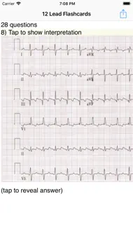 EKG Academy iphone bilder 0