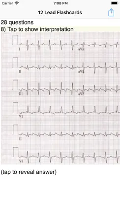 EKG Academy iPhone image 1