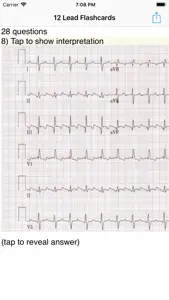 EKG Academy screenshot #1 for iPhone