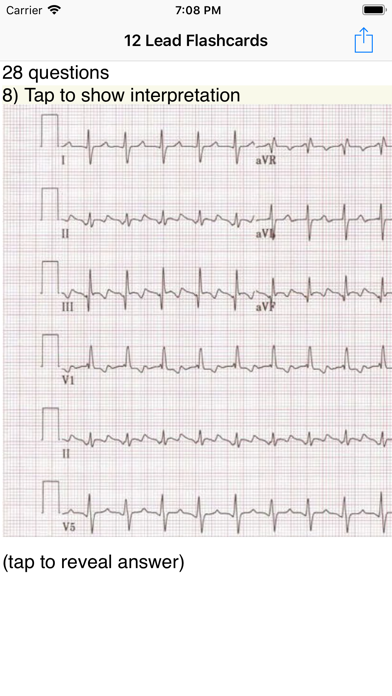 EKG Academyのおすすめ画像1