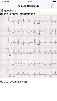 EKG Academy screenshot 1