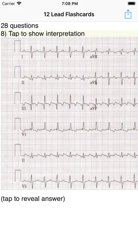 EKG Academy