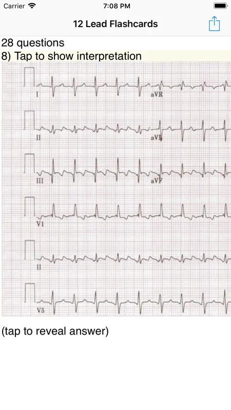 EKG Academy screenshot 1 of 4