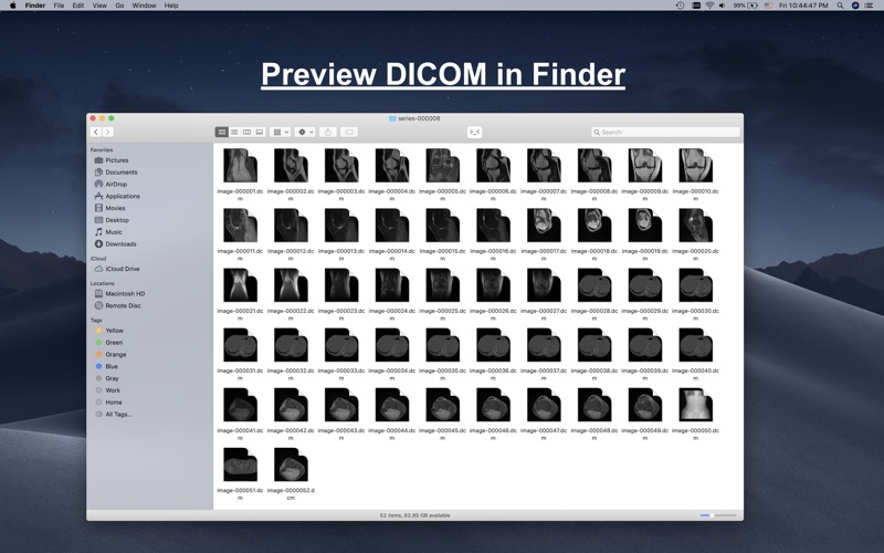 DCM Viewer Screenshot