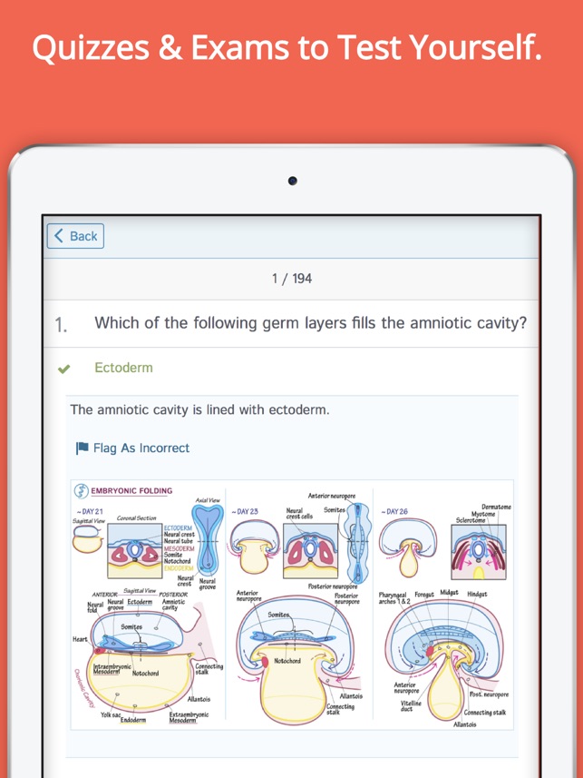 Draw It to Know It Review for Teachers