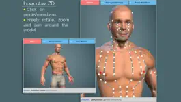 Game screenshot Easy Acupuncture 3D - LITE mod apk