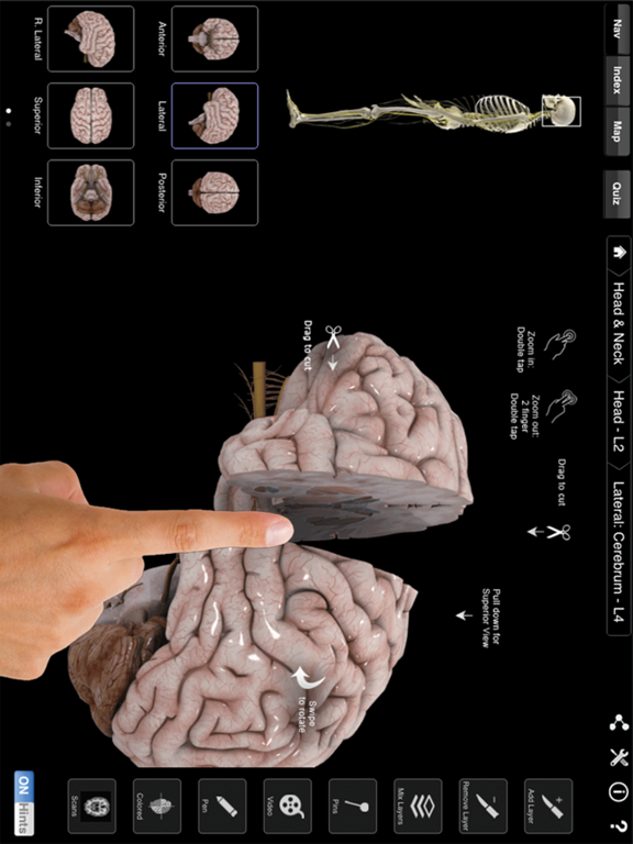 Screenshot #4 pour Brain & Nervous System Pro III