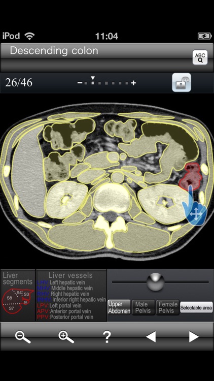 Abdominal CT Sectional Walker screenshot-4
