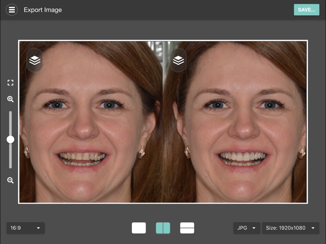 Smile Designer Pro(圖5)-速報App