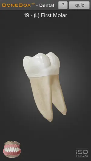 Captura de Pantalla 2 BoneBox™ - Dental Lite iphone