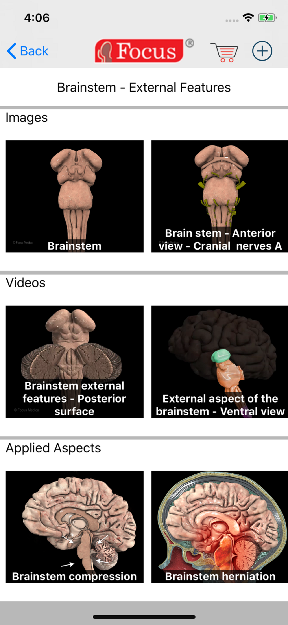 NEUROANATOMY - Digital Anatomy screenshot 3
