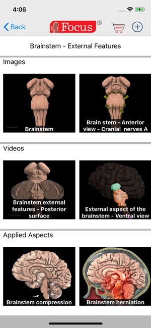 NEUROANATOMY - Digital Anatomy(圖3)-速報App