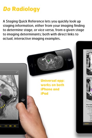 Gyn Cancer Staging Atlas screenshot 3