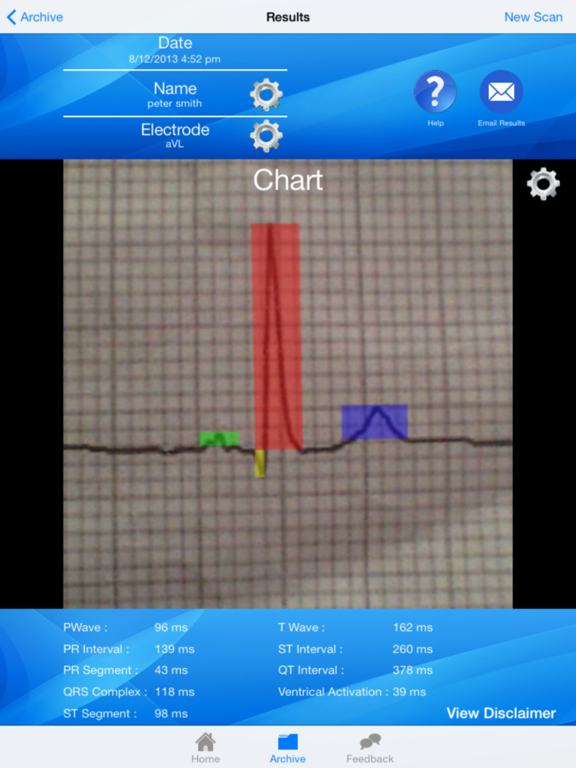 Screenshot #5 pour Doctor ECG guide & calculator