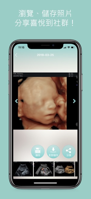 Hi Baby(圖4)-速報App