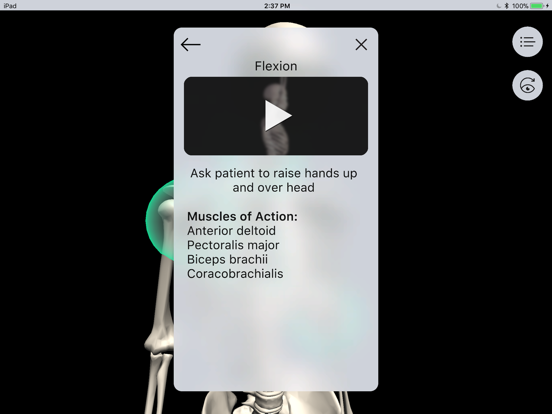 Screenshot #6 pour Musculoskeletal Pro Consult