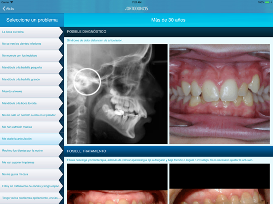 Screenshot #5 pour iOrtodoncis