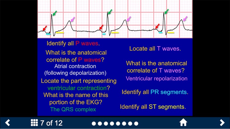 EKG - SecondLook