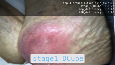 Skin Assess Screenshot