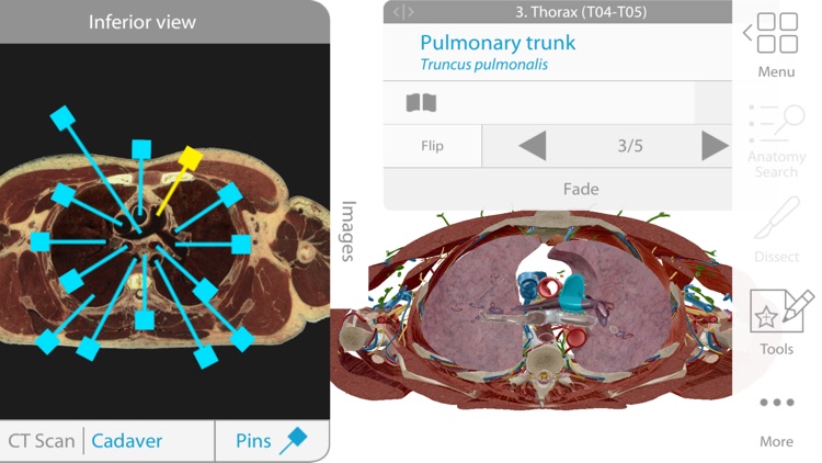 Human Anatomy Atlas 2018 screenshot-4