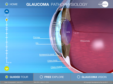 Glaucoma Education screenshot 3