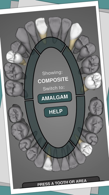 CavSim : Dental Cavity Preps
