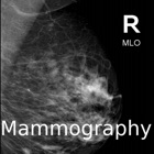 Mammogram Atlas