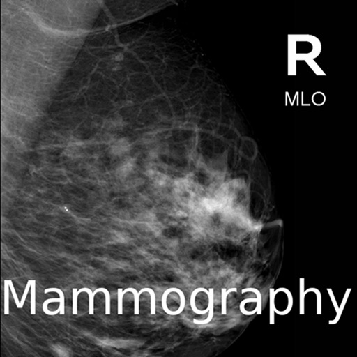 Mammogram Atlas iOS App