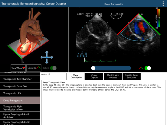 Screenshot #5 pour TEE Colour Doppler