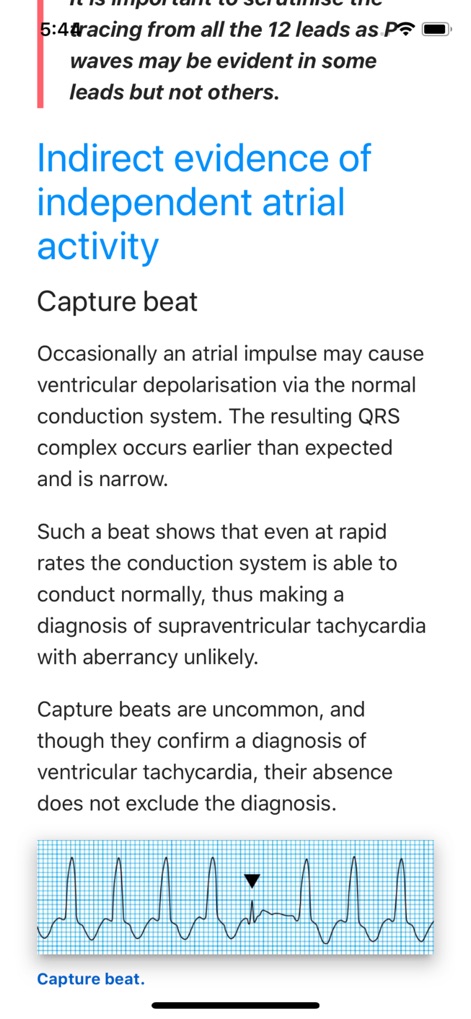 ECG Basics Lite: ECG Made Easy - Medical App | MWM
